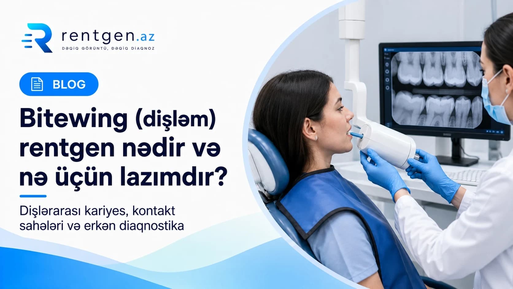 Bitewing (dişləm) rentgen nədir?