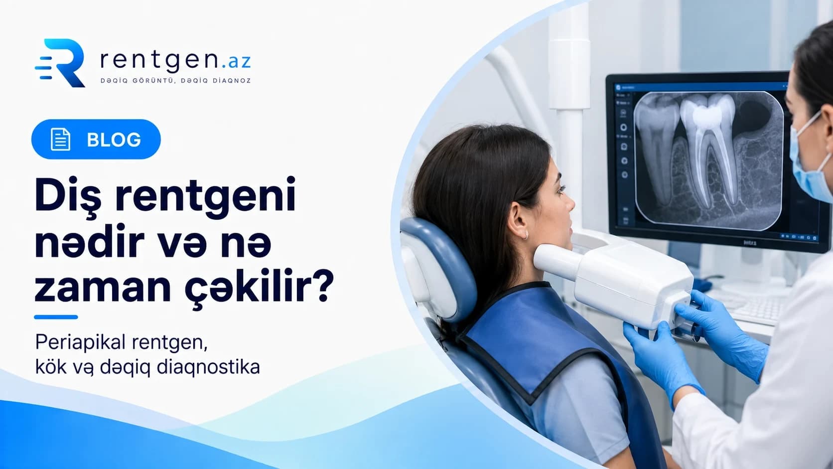 Diş rentgeni nədir və nə zaman çəkilir?
