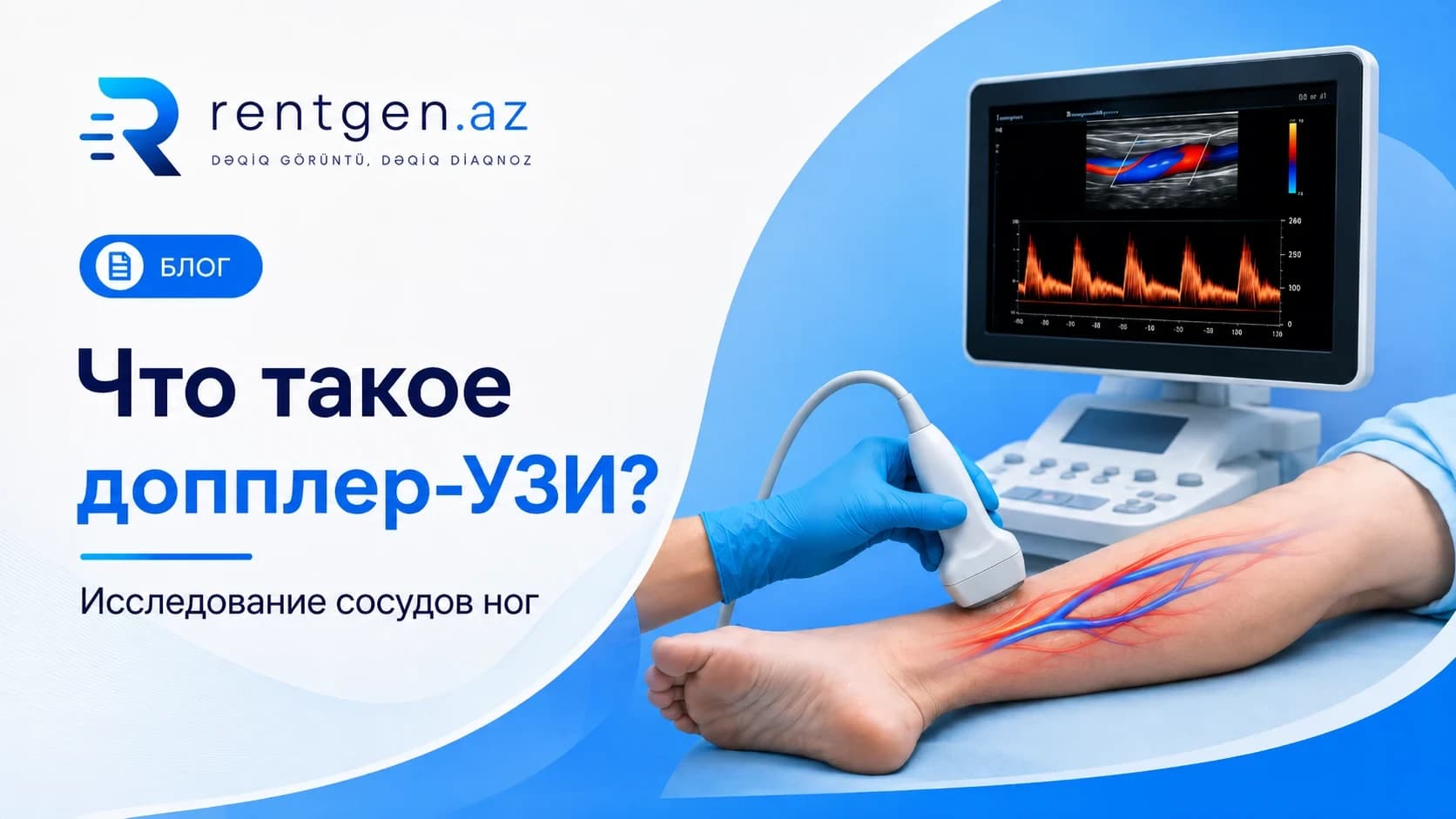 Что такое допплер-УЗИ и какие сосуды оно проверяет?