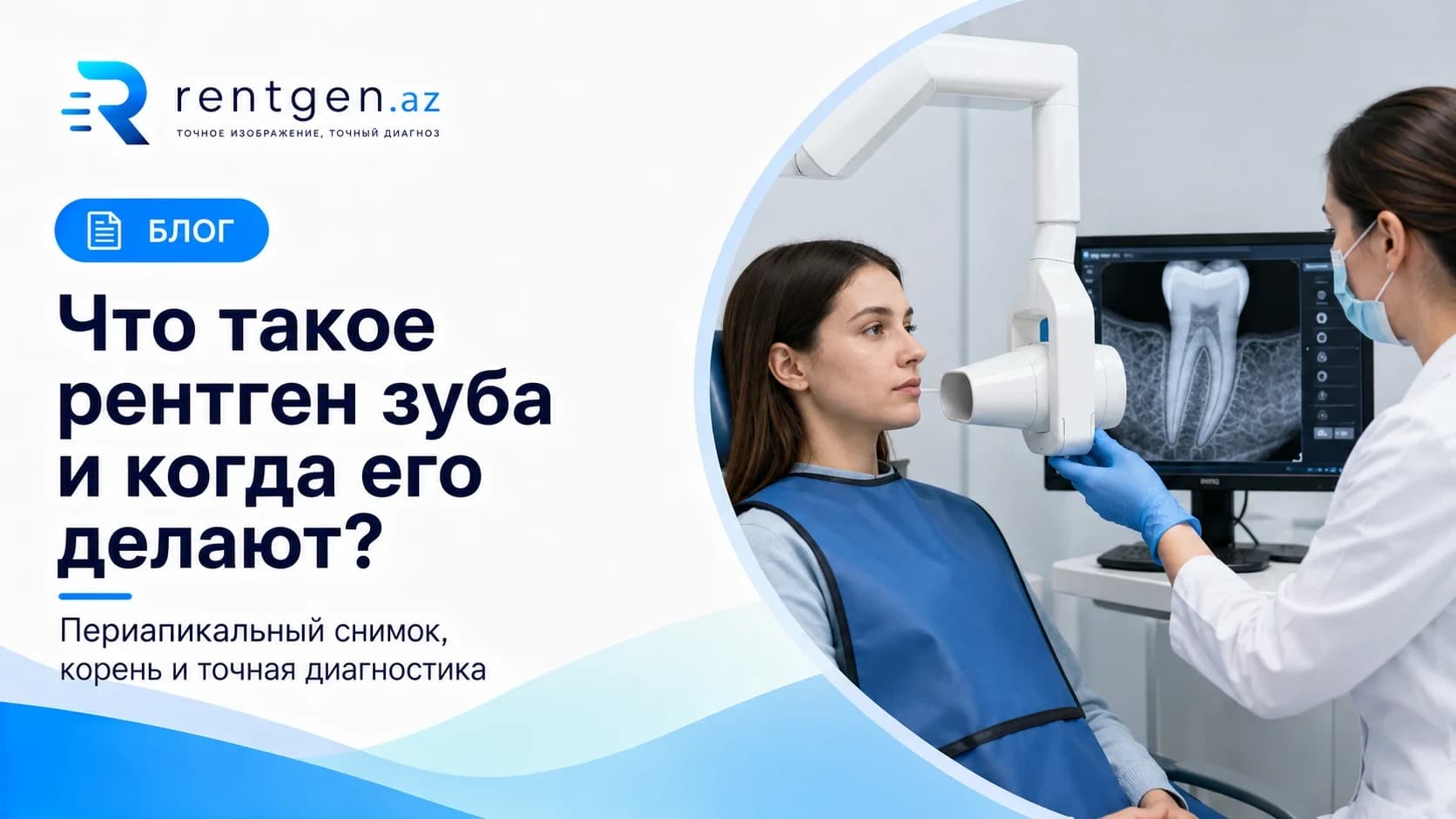 Что такое рентген зуба и когда его делают?