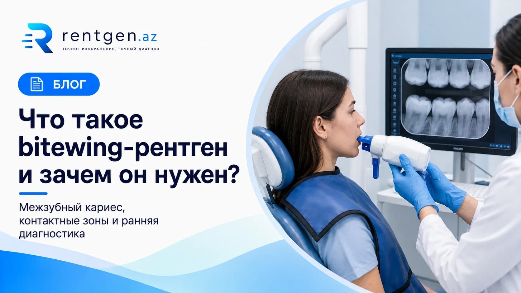 Что такое рентген Bitewing (прикусной)?