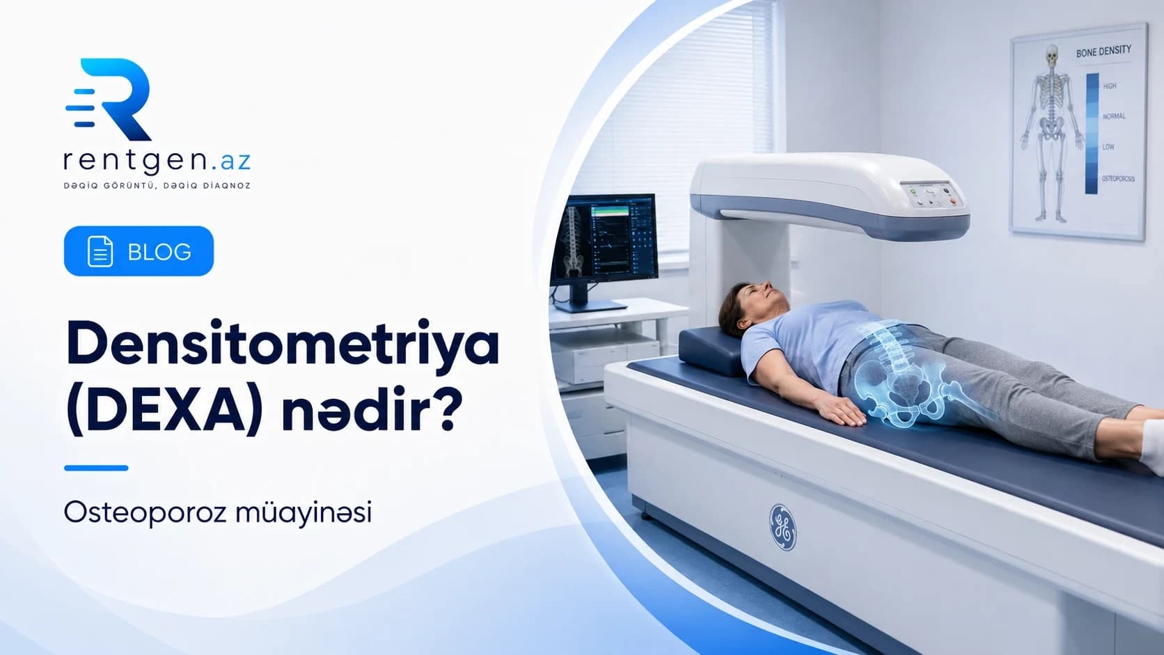 Densitometriya (DEXA) nədir — sümük sıxlığı ölçülməsi kimlərə lazımdır?