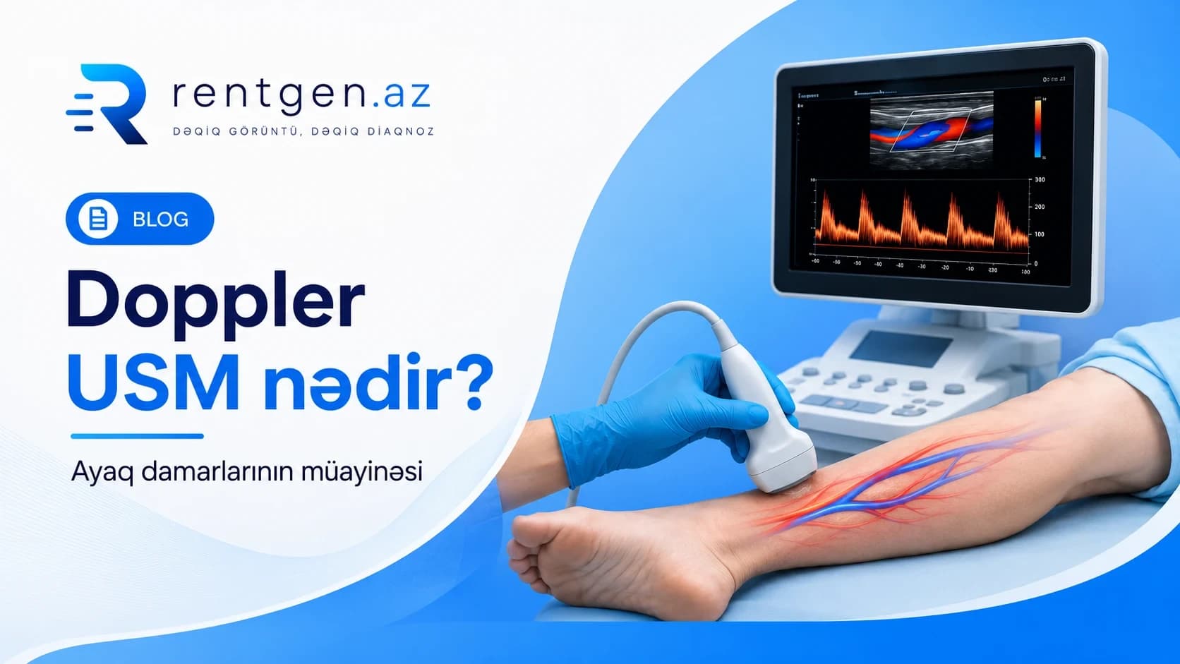 Doppler USM nədir və hansı damarları yoxlayır?