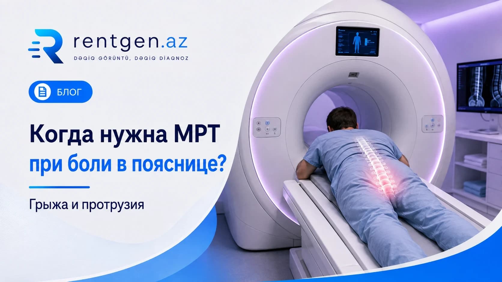Когда нужна МРТ при боли в пояснице?