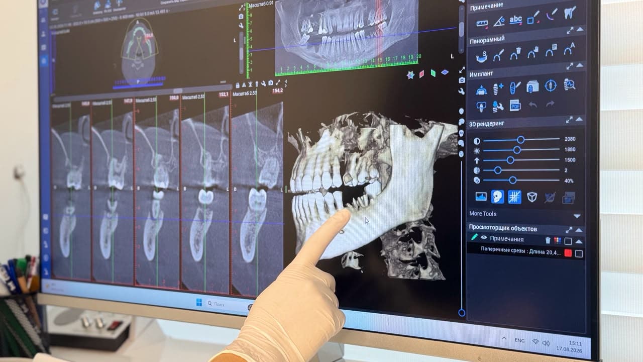 Medholding — Bakı dental rentgen mərkəzi